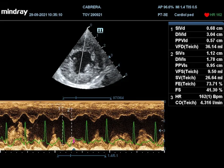 electrocardiograma veterinaria